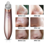 Electric Blackhead Vacuum Pore Cleaner Acne Pimple Remover Strong - Image 4