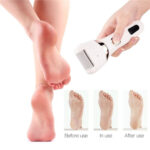 Electric Pedicure Foot Care Tool Files Pedicure Callus Remover - Image 3