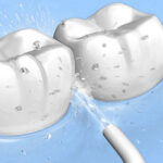 Oral Irrigator Wothident teeth cleaner germ cleaner - Image 4
