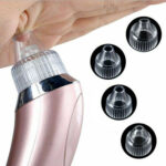 Electric Blackhead Vacuum Pore Cleaner Acne Pimple Remover Strong - Image 3