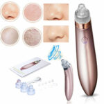 Electric Blackhead Vacuum Pore Cleaner Acne Pimple Remover Strong - Image 8
